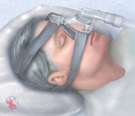 Continuous positive airway pressure (CPAP) mask