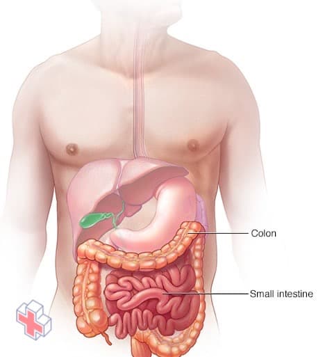 Colon and small intestine