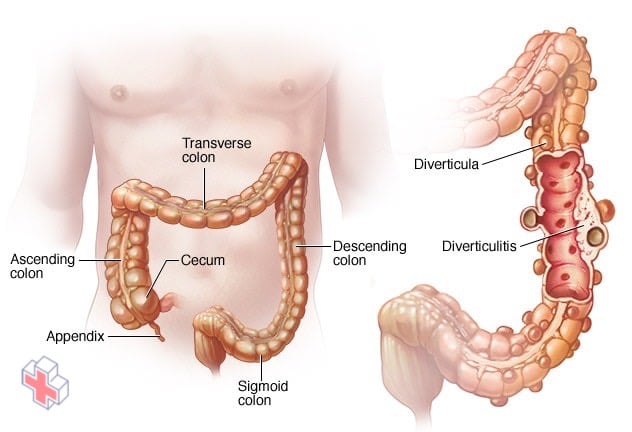 Pouches in digestive tract