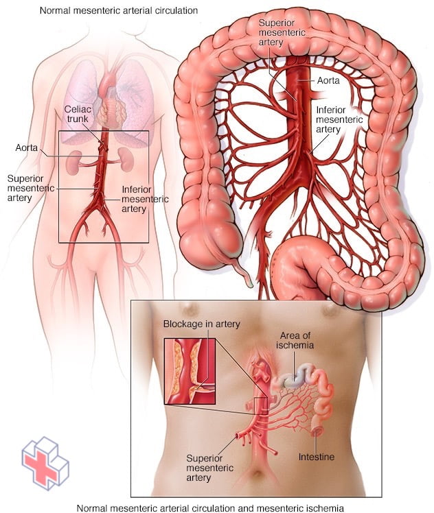 Normal mesenteric arterial circulation and mesenteric ischemia