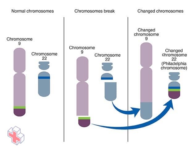 Creation of Philadelphia chromosome