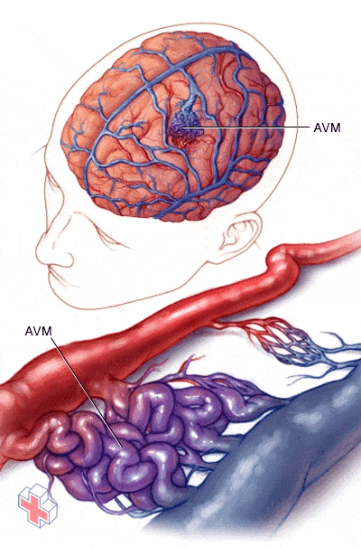 Image showing normal and abnormal blood vessels