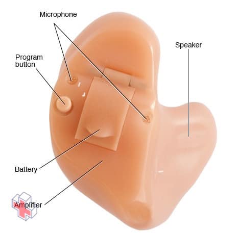 Hearing aid with common parts labeled