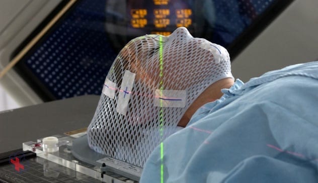 Face mask for LINAC stereotactic radiosurgery of the brain