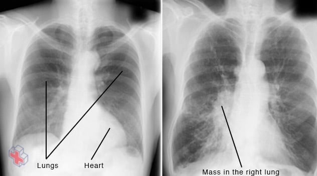 Medical image of chest X-rays