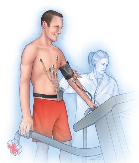 Illustration showing a man performing an exercise stress test